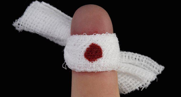 Perché il mio dito non smetterà di sanguinare?