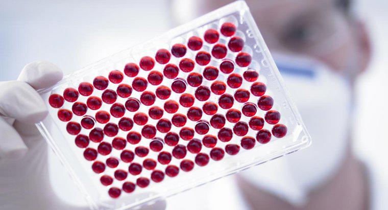 Che cosa significa Low MPV in Blood Test?