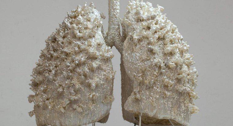 Una persona può vivere con un polmone?