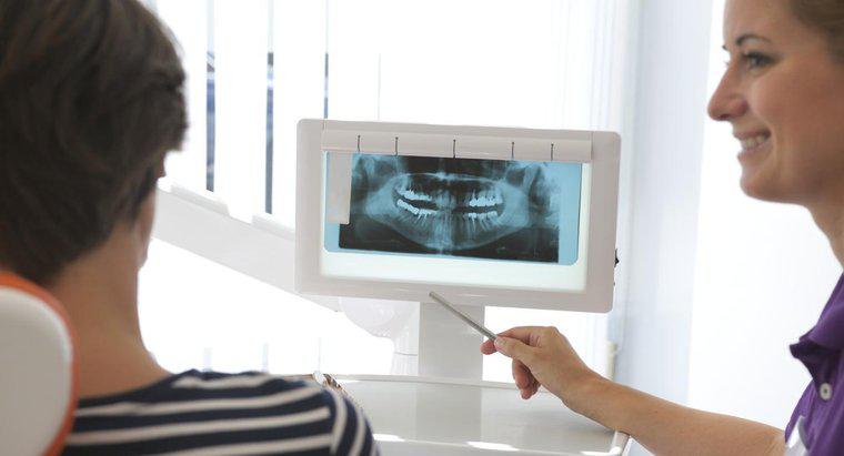 Quanto dovrei aspettarmi di pagare per gli impianti dentali?